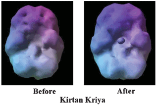 The effect of Kirtan Kriya Meditation on the brain.