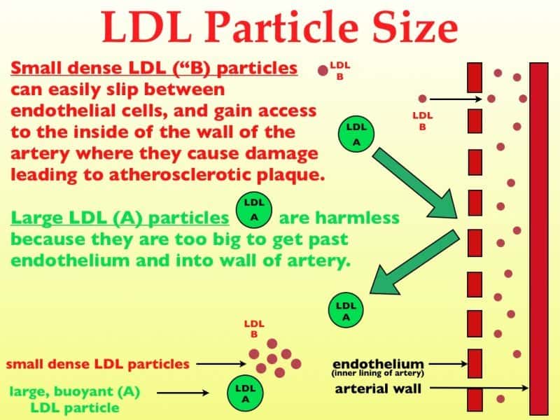 LDL cholesterol particle size matters.