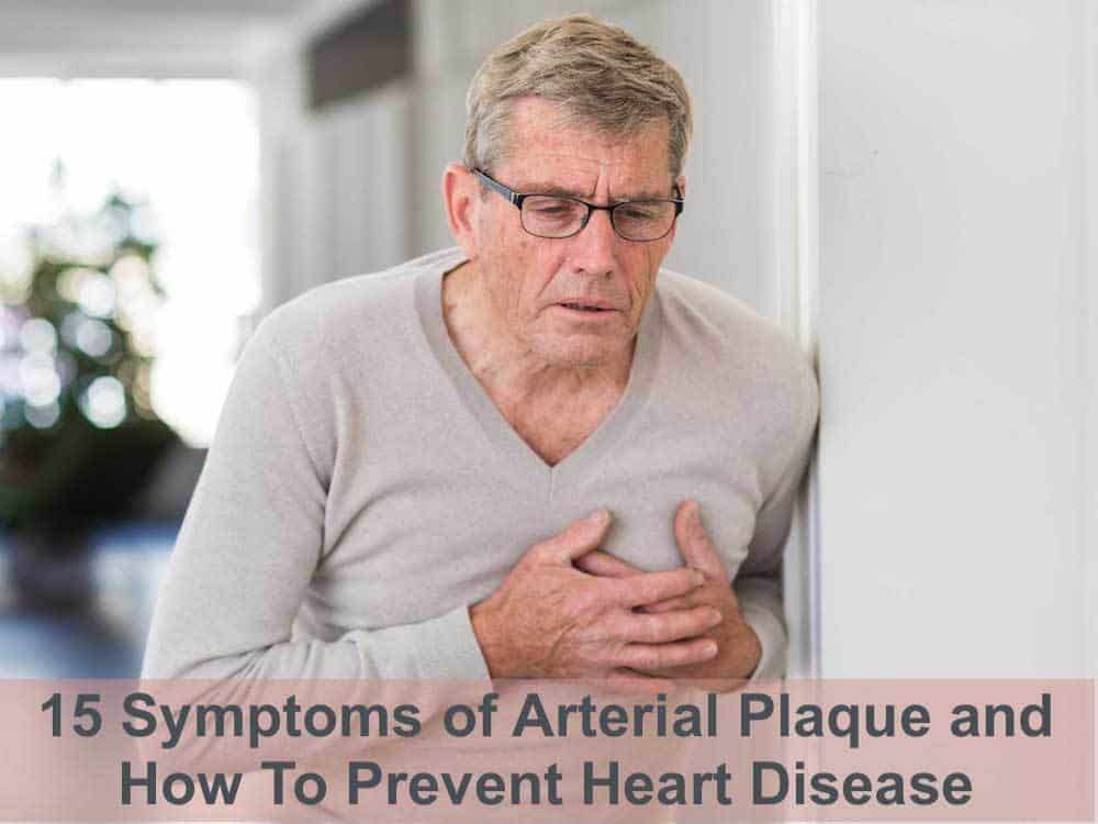 symptoms of arterial plaque