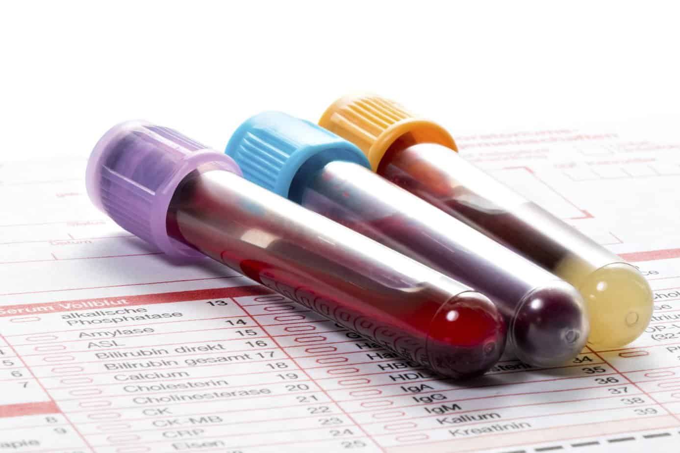 Get the blood tests you need to calculate your bioage, the age you are biologically.