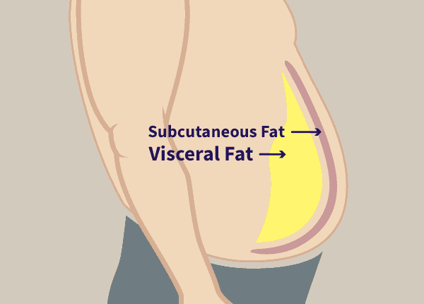 Subcutaneous fat vs visceral fat