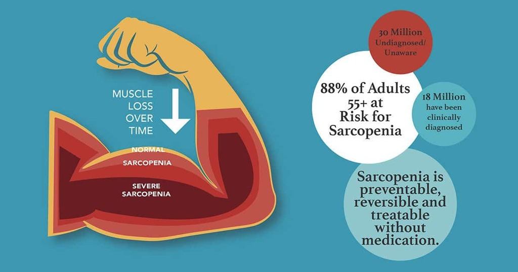 Dr Mirkin: sarcopenia is linked to heart damage