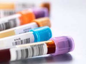 Test your insulin sensitivty with blood tests