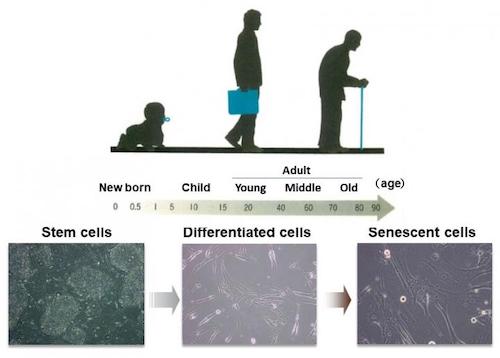 Scenecent cells proliferate as we age
